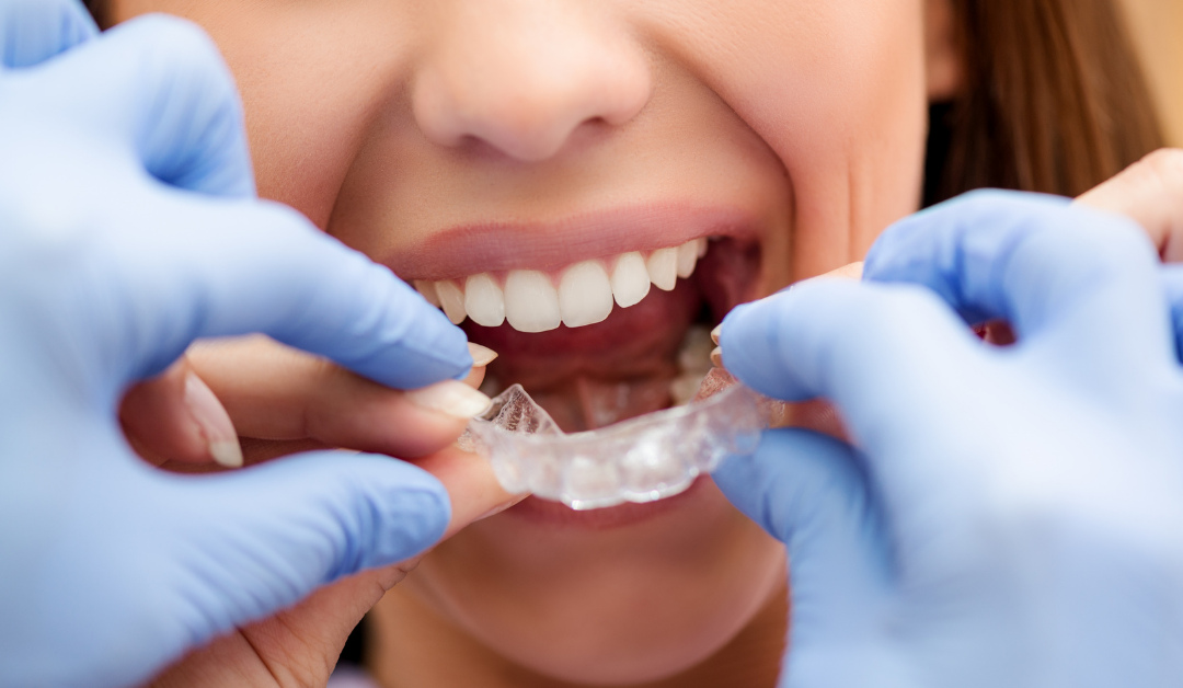 Common Orthodontic Treatments for Adults